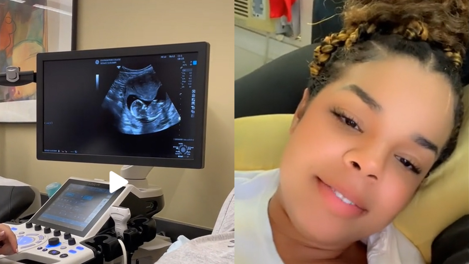 TikToker inganna gli spettatori con quotsorpresaquot bambino sul video ecografico 59